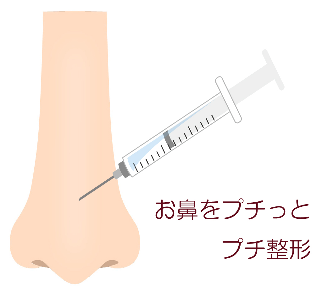 ヒアルロン酸注入