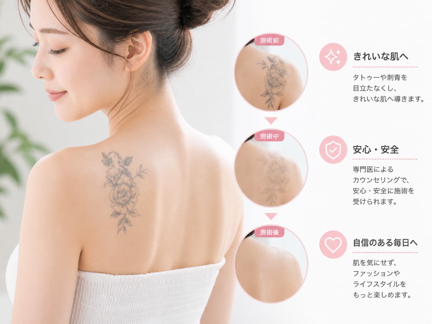 タトゥー除去の診療イメージ